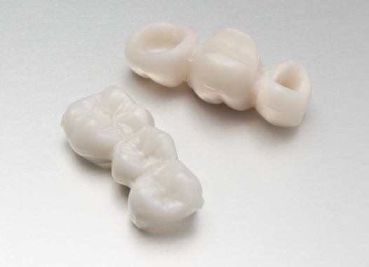 dental-temporary-dentures-bridge-pmma-nano-composite